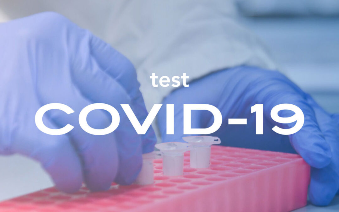 Test Anticorpale COVID-19